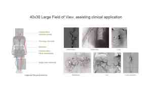 Interventional Cardiology Angiography System CG0-2100