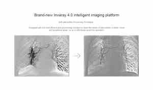 Interventional Cardiology Angiography System CG0-2100
