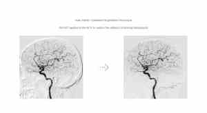Interventional Cardiology Angiography System CG0-2100